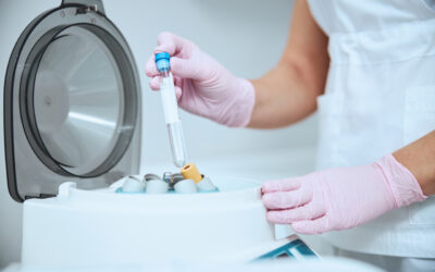 Jak zmieniają się ? Znaczenie komponentów kontaktowych